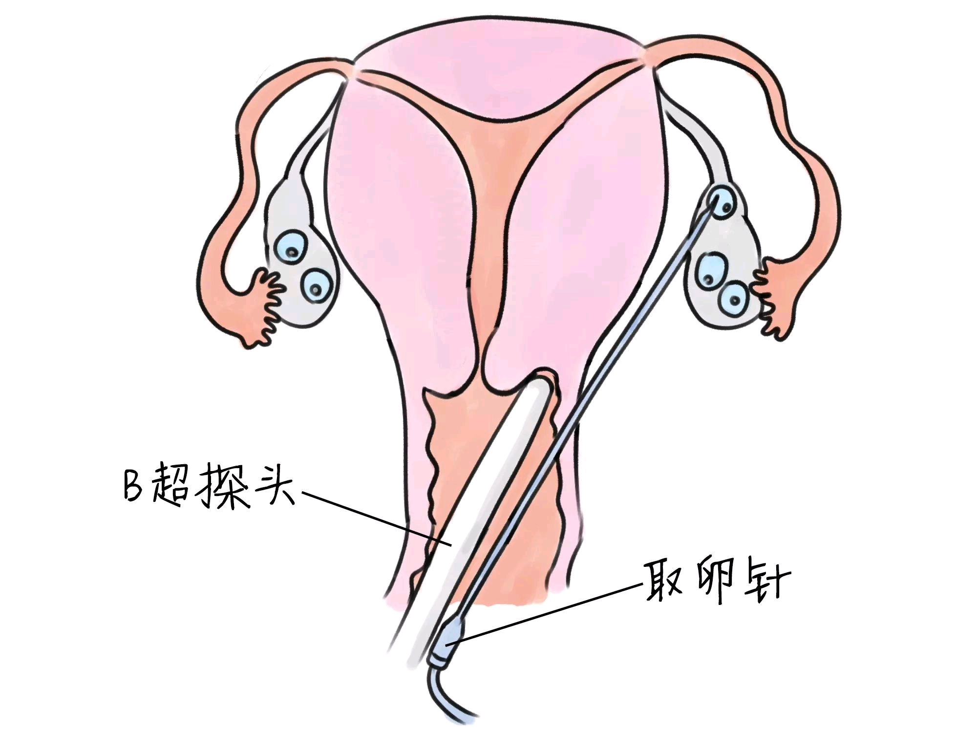 肛门指检