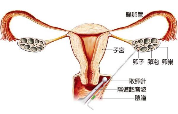 老婆生日蛋糕