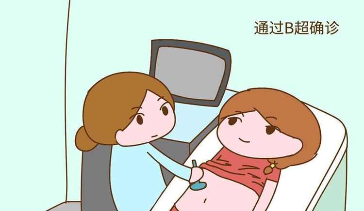 育儿专家