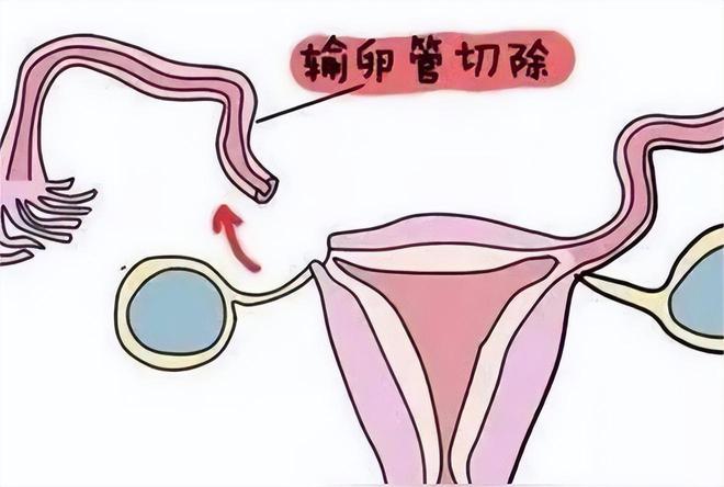 婴儿