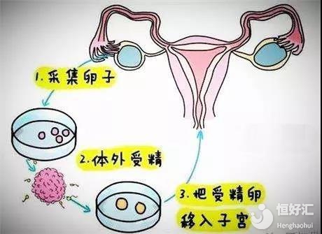 美女孕妇