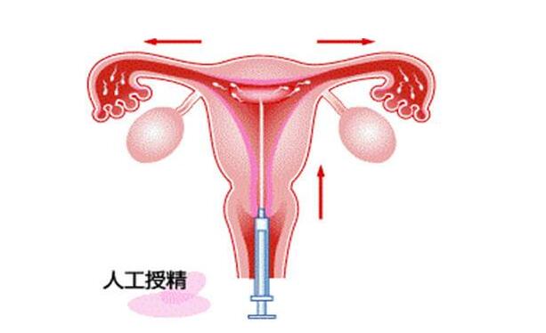 育儿师兰海视频完整版小小