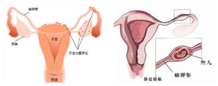 育儿心得