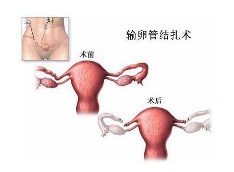 幼儿园教育